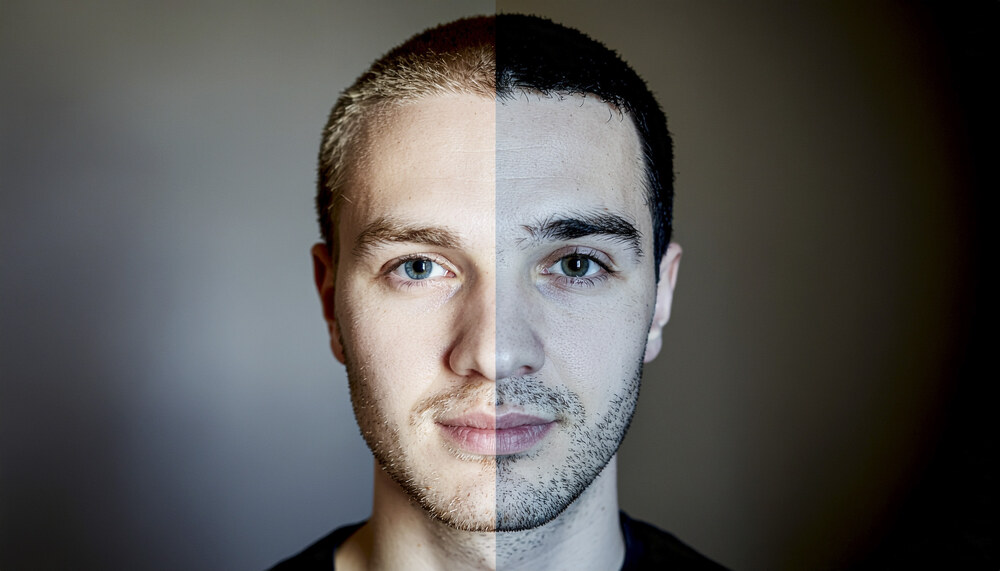 Bipolar Disorders care at Anchor of Hope Psychiatry